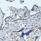 Immunohistochemistry - Anti-HOXA9 Antibody [ARC2423] (A305943) - Antibodies.com