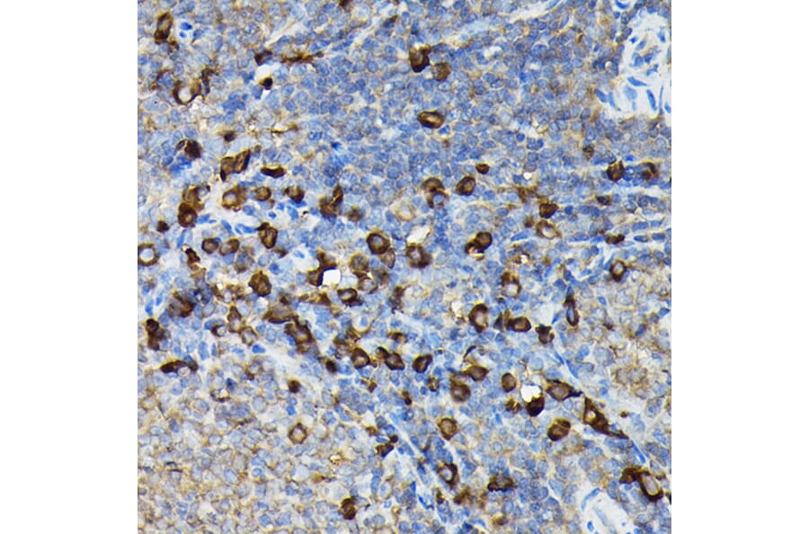Immunohistochemistry - Anti-FAM117A Antibody (A305944) - Antibodies.com