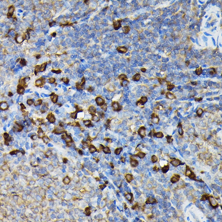 Immunohistochemistry - Anti-FAM117A Antibody (A305944) - Antibodies.com