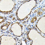 Immunohistochemistry - Anti-FAM117A Antibody (A305944) - Antibodies.com