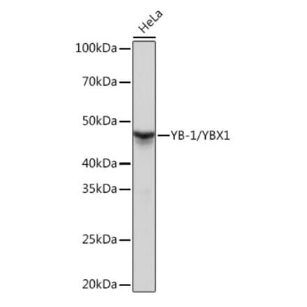 Western Blot - Anti-YB1 Antibody [ARC0797] (A305945) - Antibodies.com