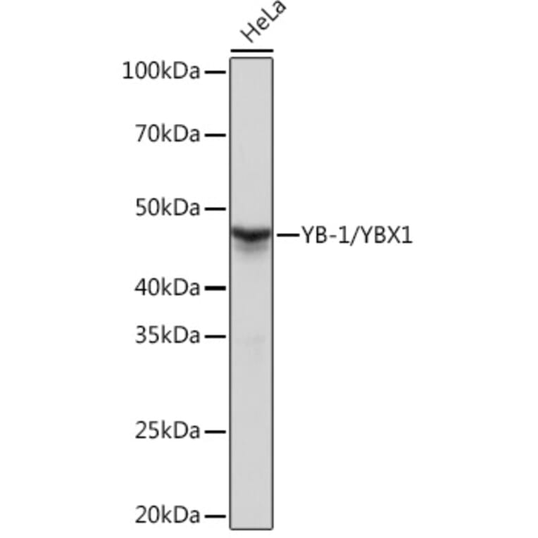 Western Blot - Anti-YB1 Antibody [ARC0797] (A305945) - Antibodies.com