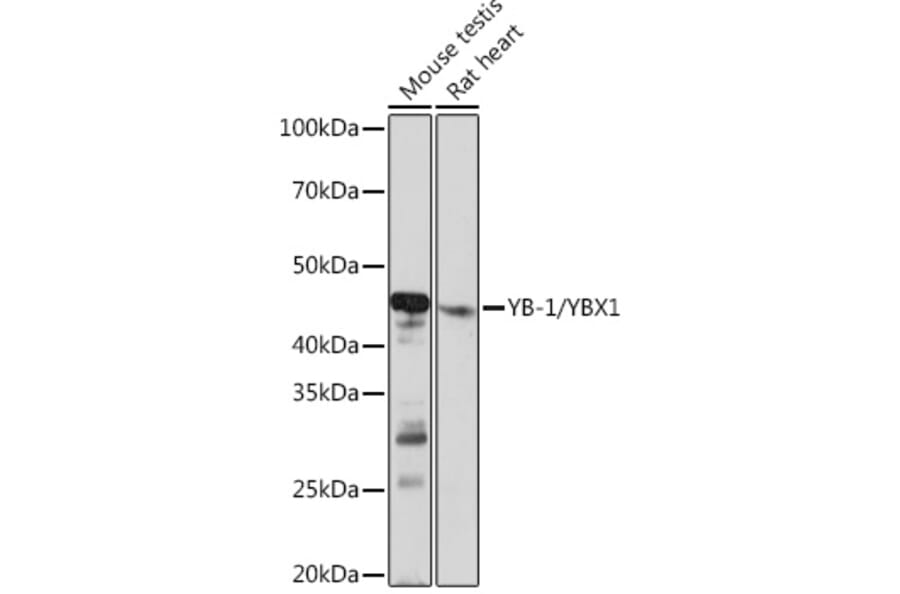 Western Blot - Anti-YB1 Antibody [ARC0797] (A305945) - Antibodies.com