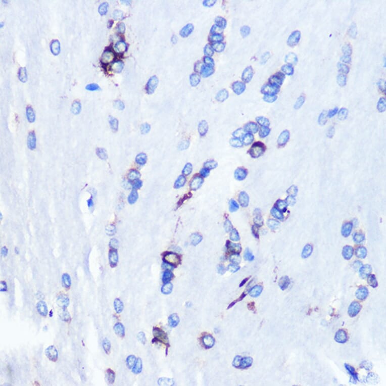 Immunohistochemistry - Anti-YB1 Antibody [ARC0797] (A305945) - Antibodies.com