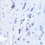 Immunohistochemistry - Anti-YB1 Antibody [ARC0797] (A305945) - Antibodies.com