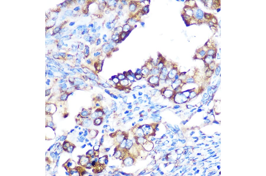 Immunohistochemistry - Anti-YB1 Antibody [ARC0797] (A305945) - Antibodies.com