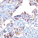 Immunohistochemistry - Anti-YB1 Antibody [ARC0797] (A305945) - Antibodies.com
