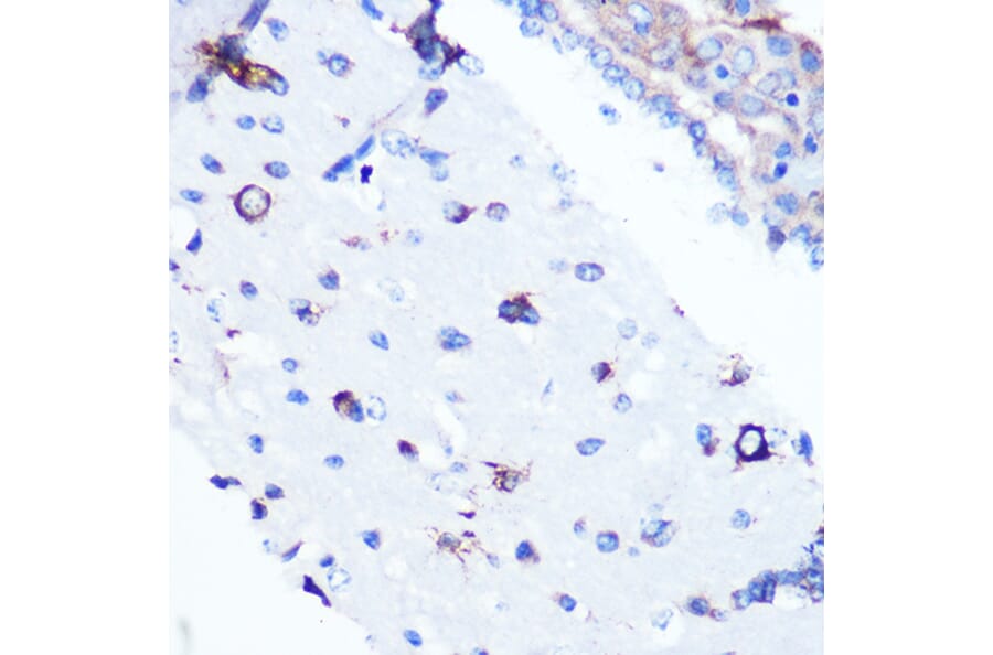 Immunohistochemistry - Anti-YB1 Antibody [ARC0797] (A305945) - Antibodies.com