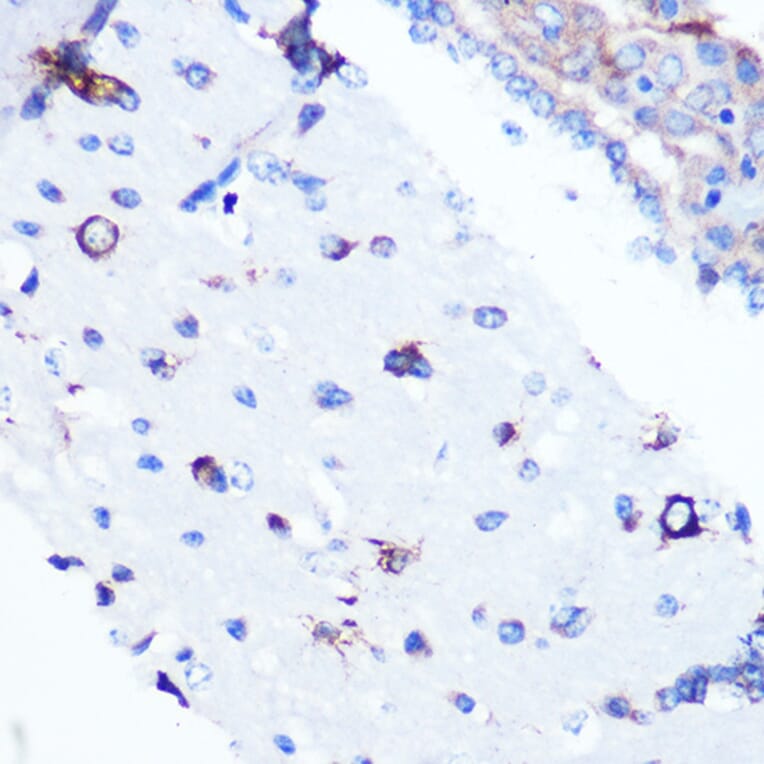 Immunohistochemistry - Anti-YB1 Antibody [ARC0797] (A305945) - Antibodies.com