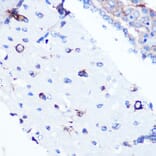 Immunohistochemistry - Anti-YB1 Antibody [ARC0797] (A305945) - Antibodies.com