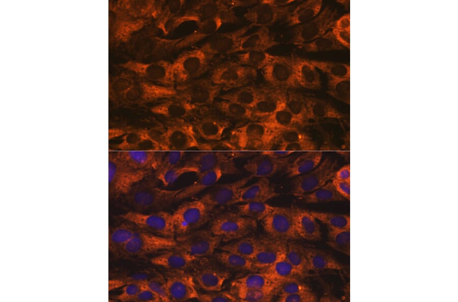 Immunofluorescence - Anti-YB1 Antibody [ARC0797] (A305945) - Antibodies.com
