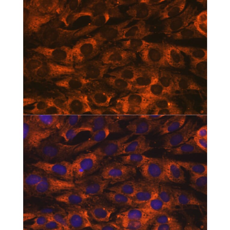 Immunofluorescence - Anti-YB1 Antibody [ARC0797] (A305945) - Antibodies.com