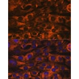 Immunofluorescence - Anti-YB1 Antibody [ARC0797] (A305945) - Antibodies.com