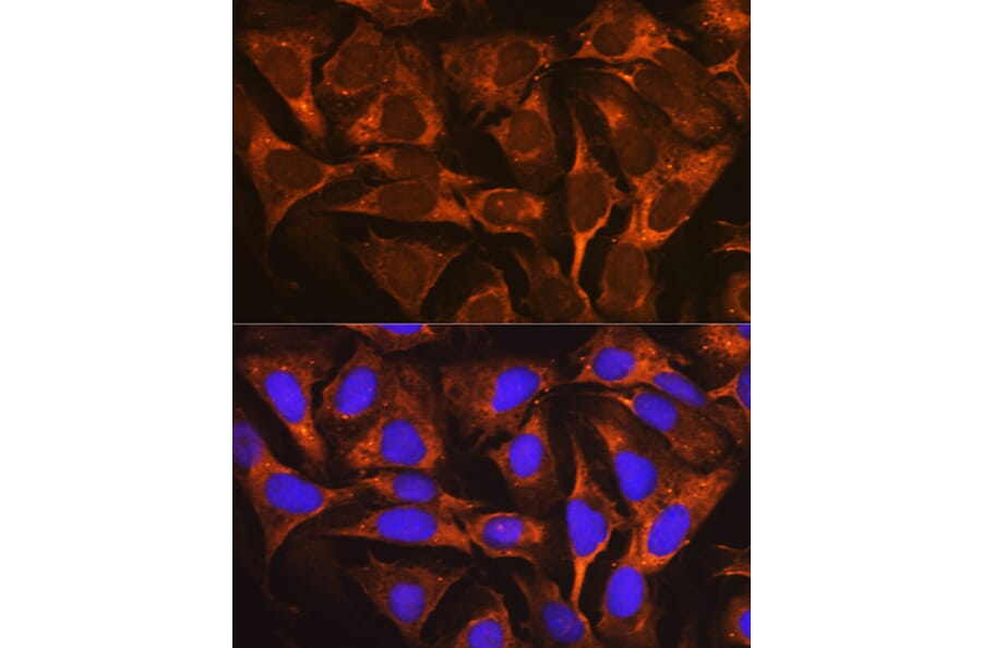 Immunofluorescence - Anti-YB1 Antibody [ARC0797] (A305945) - Antibodies.com