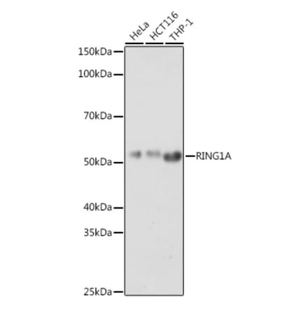 Western Blot - Anti-RING1 Antibody (A305946) - Antibodies.com