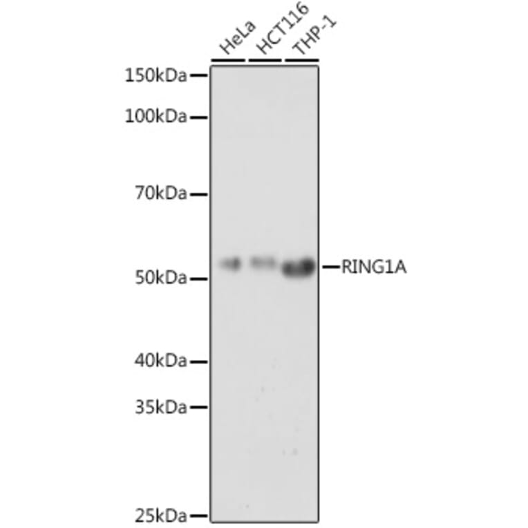 Western Blot - Anti-RING1 Antibody (A305946) - Antibodies.com