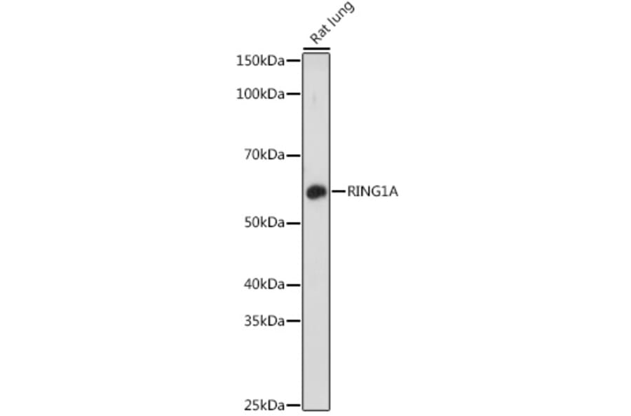 Western Blot - Anti-RING1 Antibody (A305946) - Antibodies.com