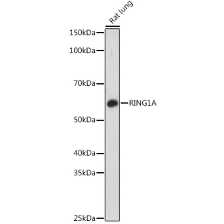 Western Blot - Anti-RING1 Antibody (A305946) - Antibodies.com