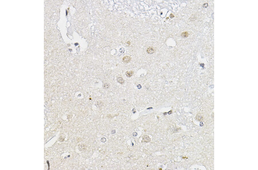 Immunohistochemistry - Anti-RING1 Antibody (A305946) - Antibodies.com