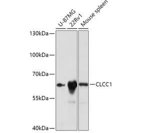 Western Blot - Anti-CLCC1 Antibody (A305947) - Antibodies.com