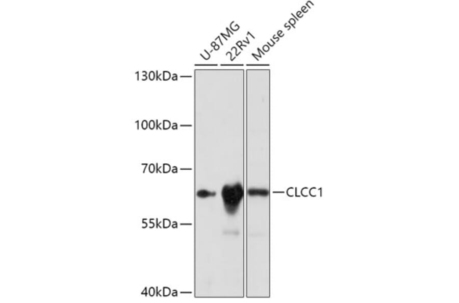 Western Blot - Anti-CLCC1 Antibody (A305947) - Antibodies.com