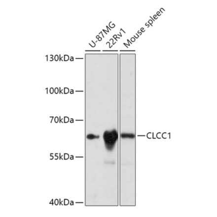 Western Blot - Anti-CLCC1 Antibody (A305947) - Antibodies.com