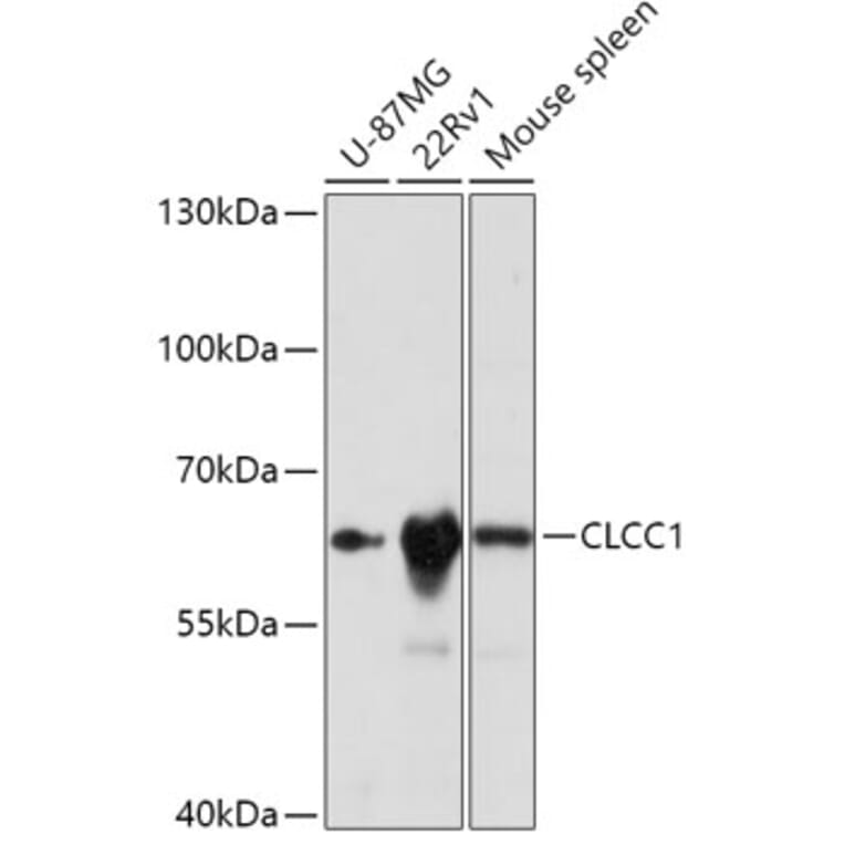 Western Blot - Anti-CLCC1 Antibody (A305947) - Antibodies.com
