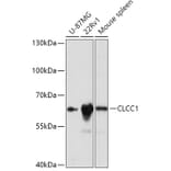 Western Blot - Anti-CLCC1 Antibody (A305947) - Antibodies.com