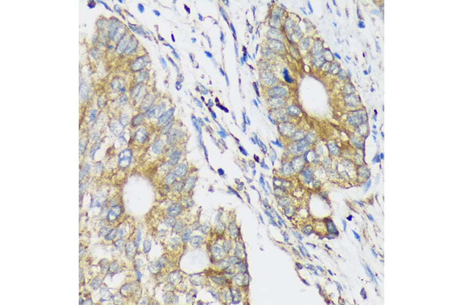 Immunohistochemistry - Anti-CLCC1 Antibody (A305947) - Antibodies.com