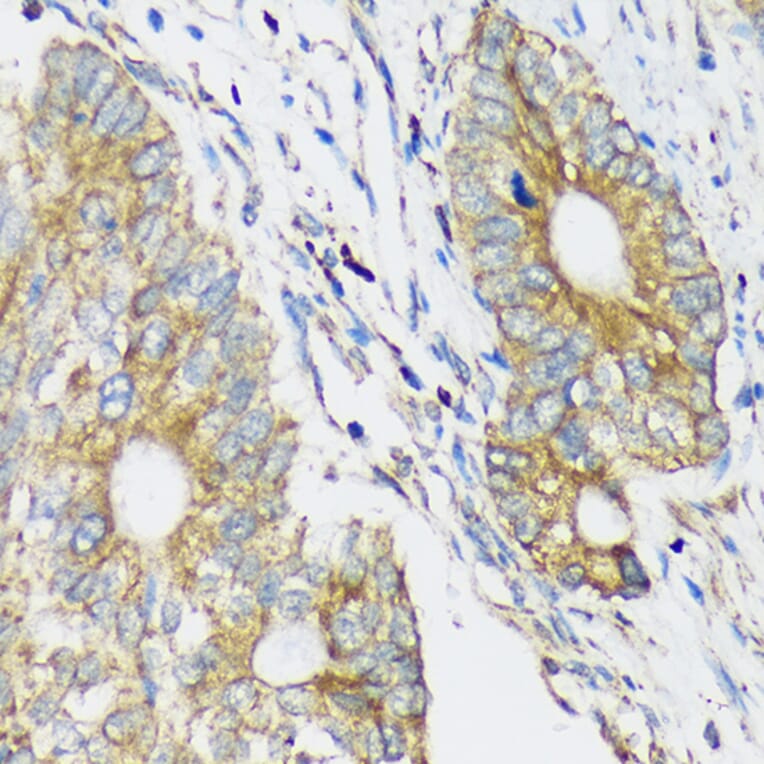 Immunohistochemistry - Anti-CLCC1 Antibody (A305947) - Antibodies.com
