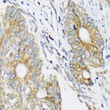 Immunohistochemistry - Anti-CLCC1 Antibody (A305947) - Antibodies.com