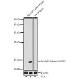 Western Blot - Anti-Histone H4 (acetyl Lys16) Antibody (A305948) - Antibodies.com