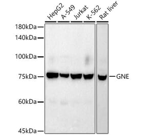 Western Blot - Anti-GNE Antibody [ARC2970] (A305949) - Antibodies.com