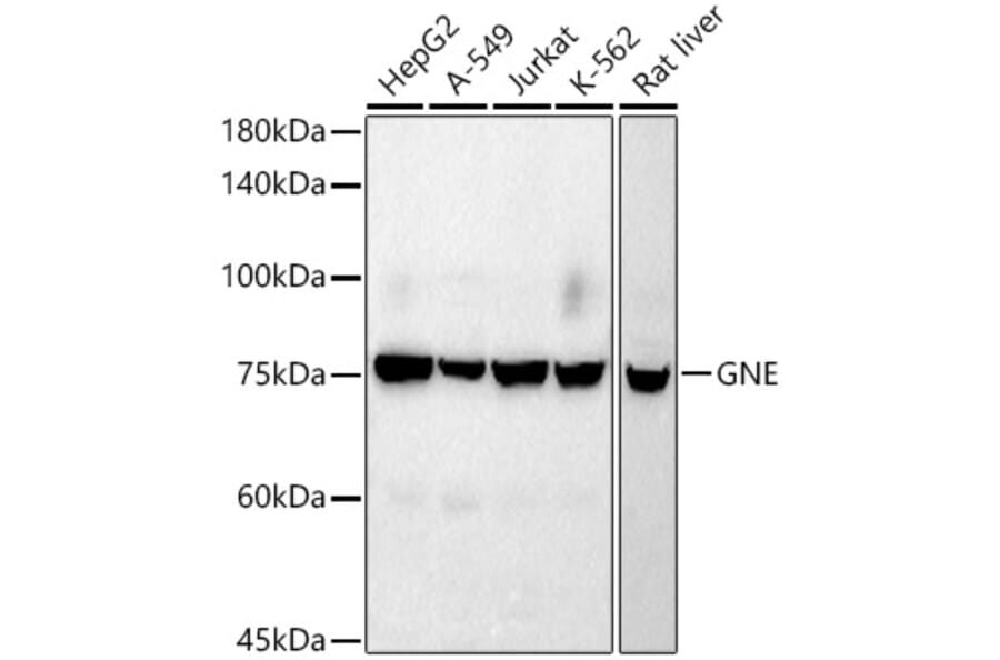 Western Blot - Anti-GNE Antibody [ARC2970] (A305949) - Antibodies.com