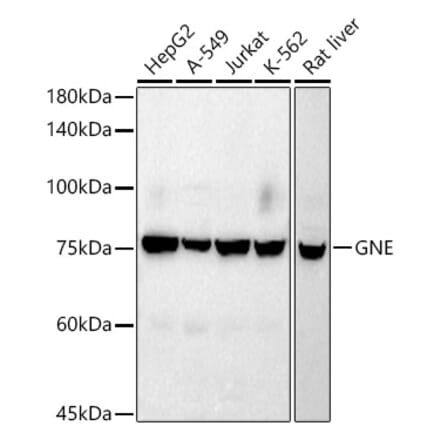 Western Blot - Anti-GNE Antibody [ARC2970] (A305949) - Antibodies.com