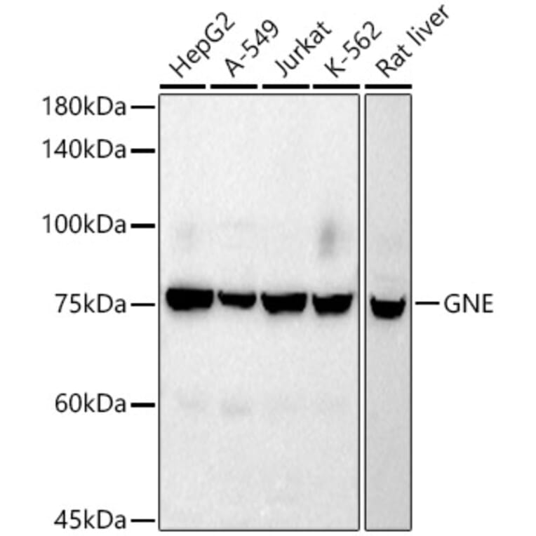 Western Blot - Anti-GNE Antibody [ARC2970] (A305949) - Antibodies.com