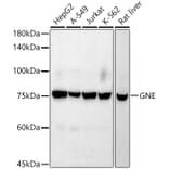 Western Blot - Anti-GNE Antibody [ARC2970] (A305949) - Antibodies.com