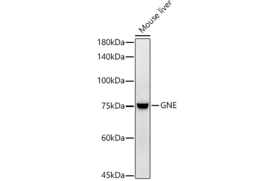 Western Blot - Anti-GNE Antibody [ARC2970] (A305949) - Antibodies.com