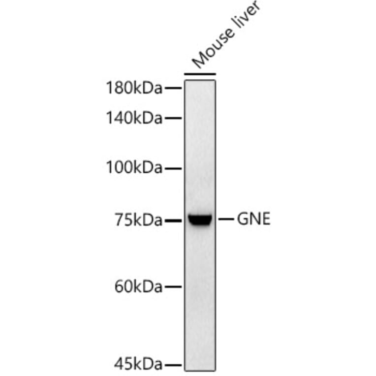 Western Blot - Anti-GNE Antibody [ARC2970] (A305949) - Antibodies.com