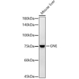 Western Blot - Anti-GNE Antibody [ARC2970] (A305949) - Antibodies.com