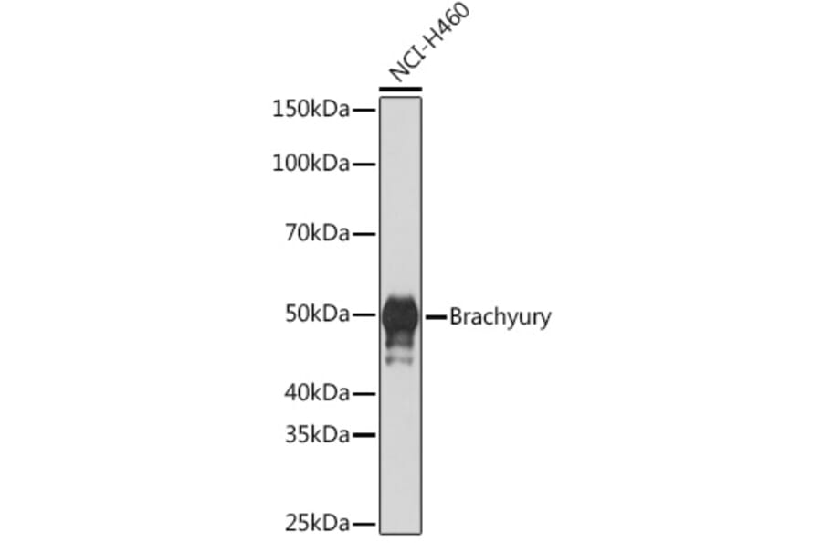 Western Blot - Anti-Brachyury/Bry Antibody [ARC1983] (A305951) - Antibodies.com