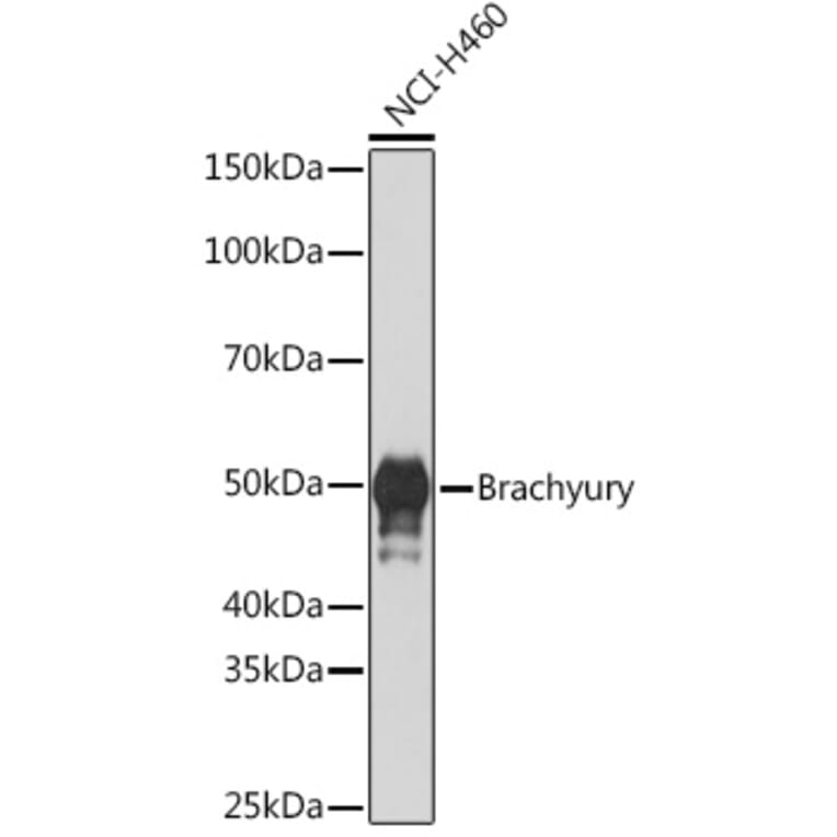 Western Blot - Anti-Brachyury/Bry Antibody [ARC1983] (A305951) - Antibodies.com