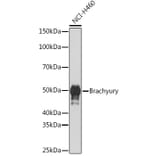 Western Blot - Anti-Brachyury/Bry Antibody [ARC1983] (A305951) - Antibodies.com