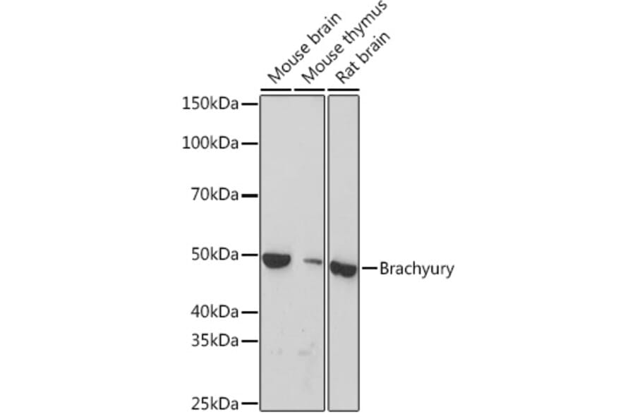 Western Blot - Anti-Brachyury/Bry Antibody [ARC1983] (A305951) - Antibodies.com