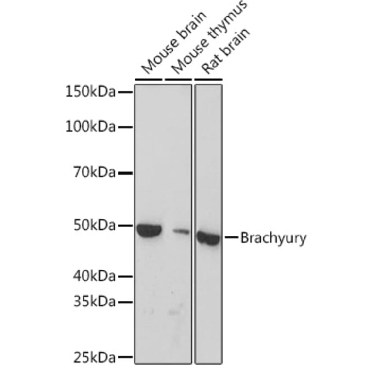 Western Blot - Anti-Brachyury/Bry Antibody [ARC1983] (A305951) - Antibodies.com