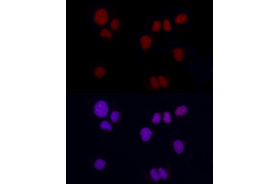 Immunofluorescence - Anti-Brachyury/Bry Antibody [ARC1983] (A305951) - Antibodies.com