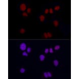 Immunofluorescence - Anti-Brachyury/Bry Antibody [ARC1983] (A305951) - Antibodies.com