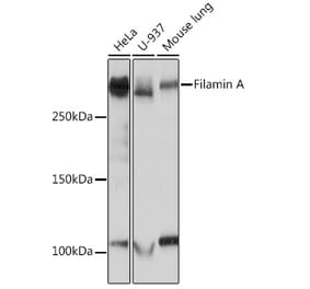 Western Blot - Anti-Filamin A Antibody [ARC0242] (A305952) - Antibodies.com