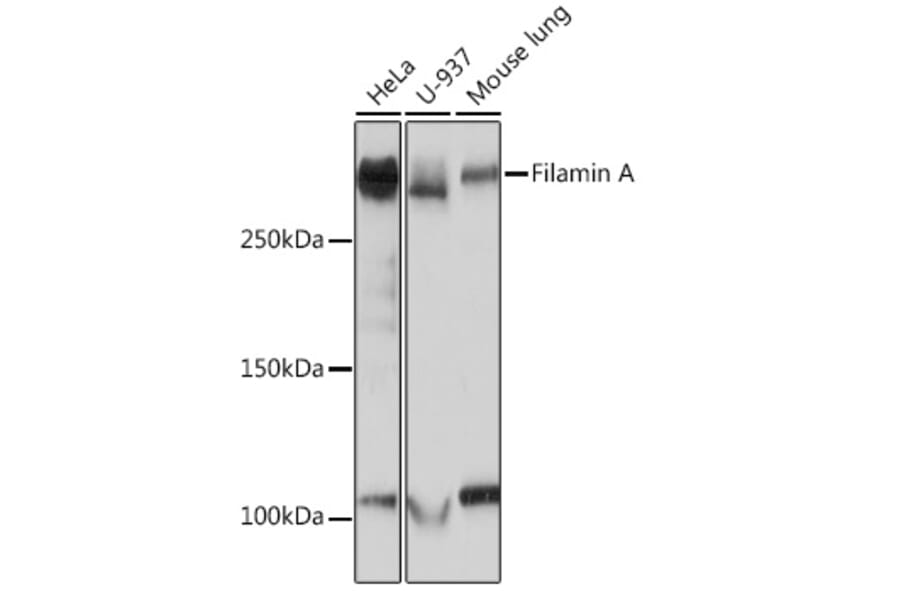 Western Blot - Anti-Filamin A Antibody [ARC0242] (A305952) - Antibodies.com