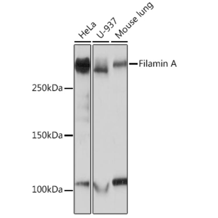 Western Blot - Anti-Filamin A Antibody [ARC0242] (A305952) - Antibodies.com